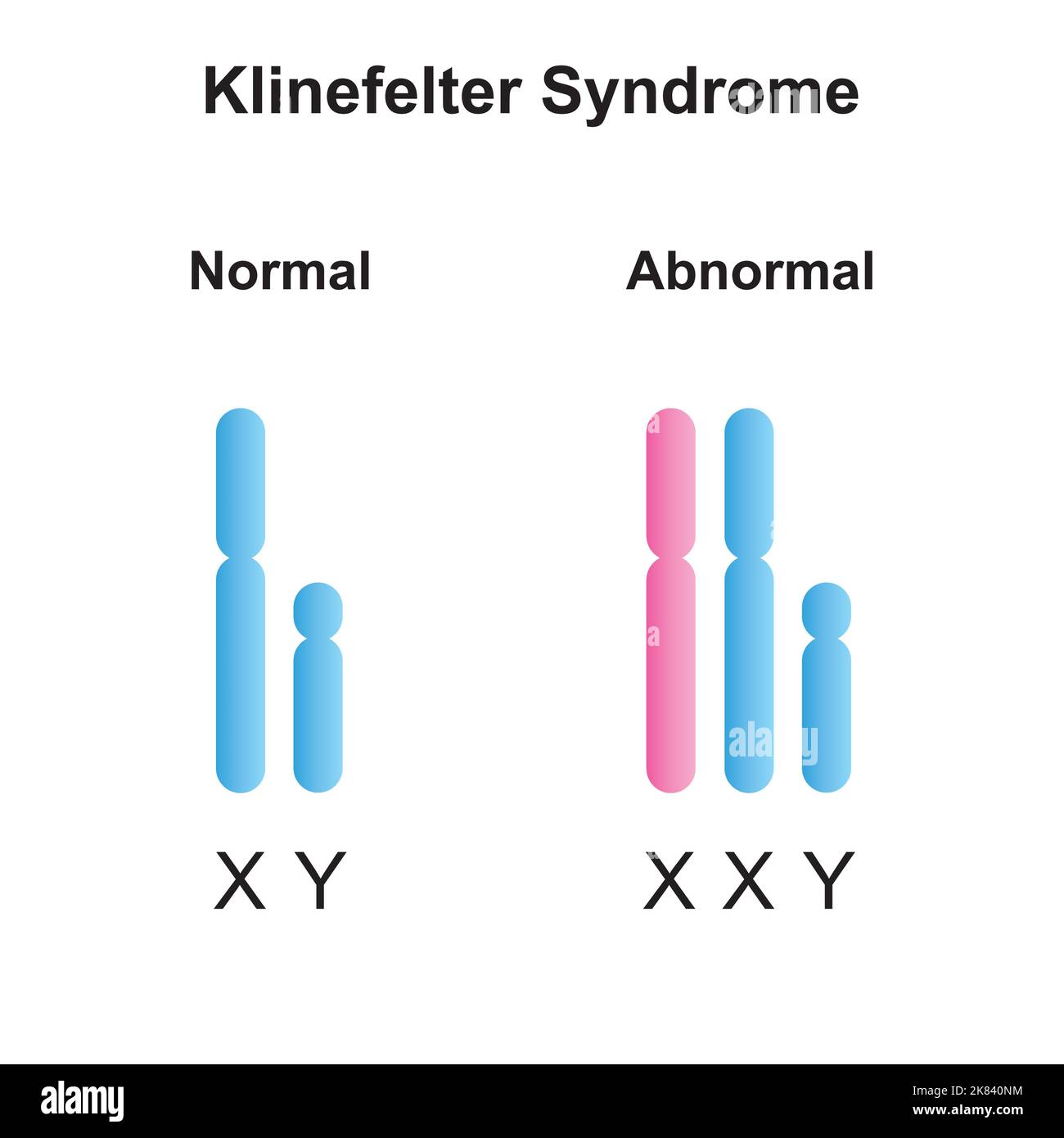 Progettazione scientifica della sindrome di Klinefelter (XXY). Simboli colorati. Illustrazione vettoriale. Illustrazione Vettoriale