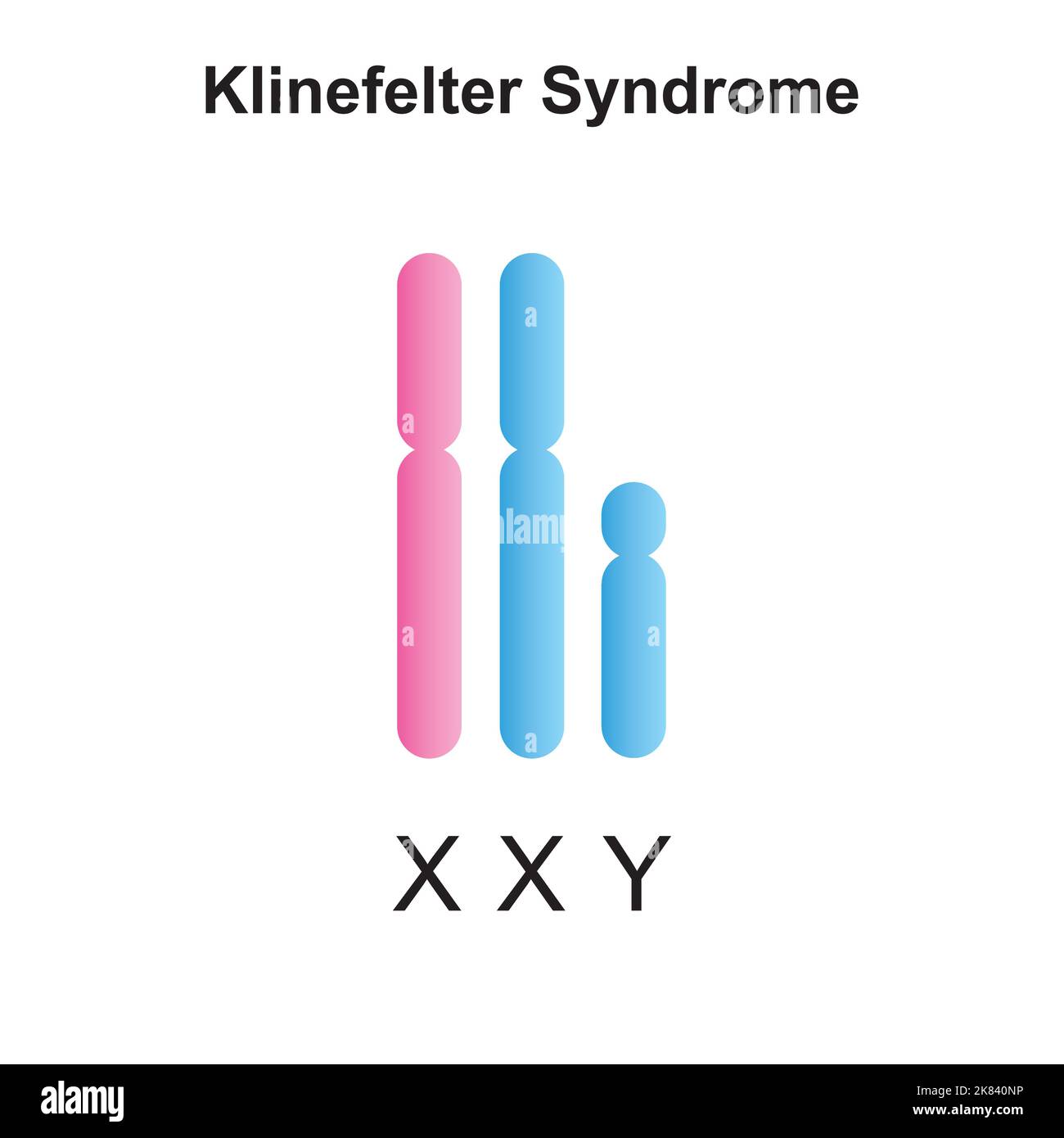 Progettazione scientifica della sindrome di Klinefelter (XXY). Simboli colorati. Illustrazione vettoriale. Illustrazione Vettoriale