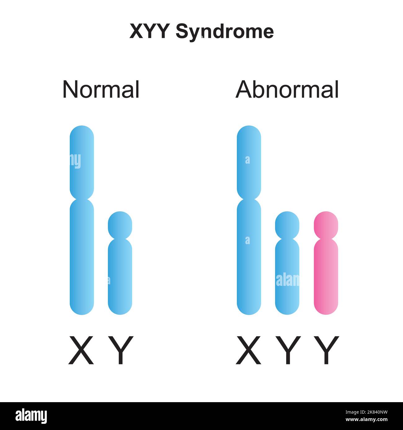 Progettazione scientifica della sindrome di Jacobs (XYY). Simboli colorati. Illustrazione vettoriale. Illustrazione Vettoriale