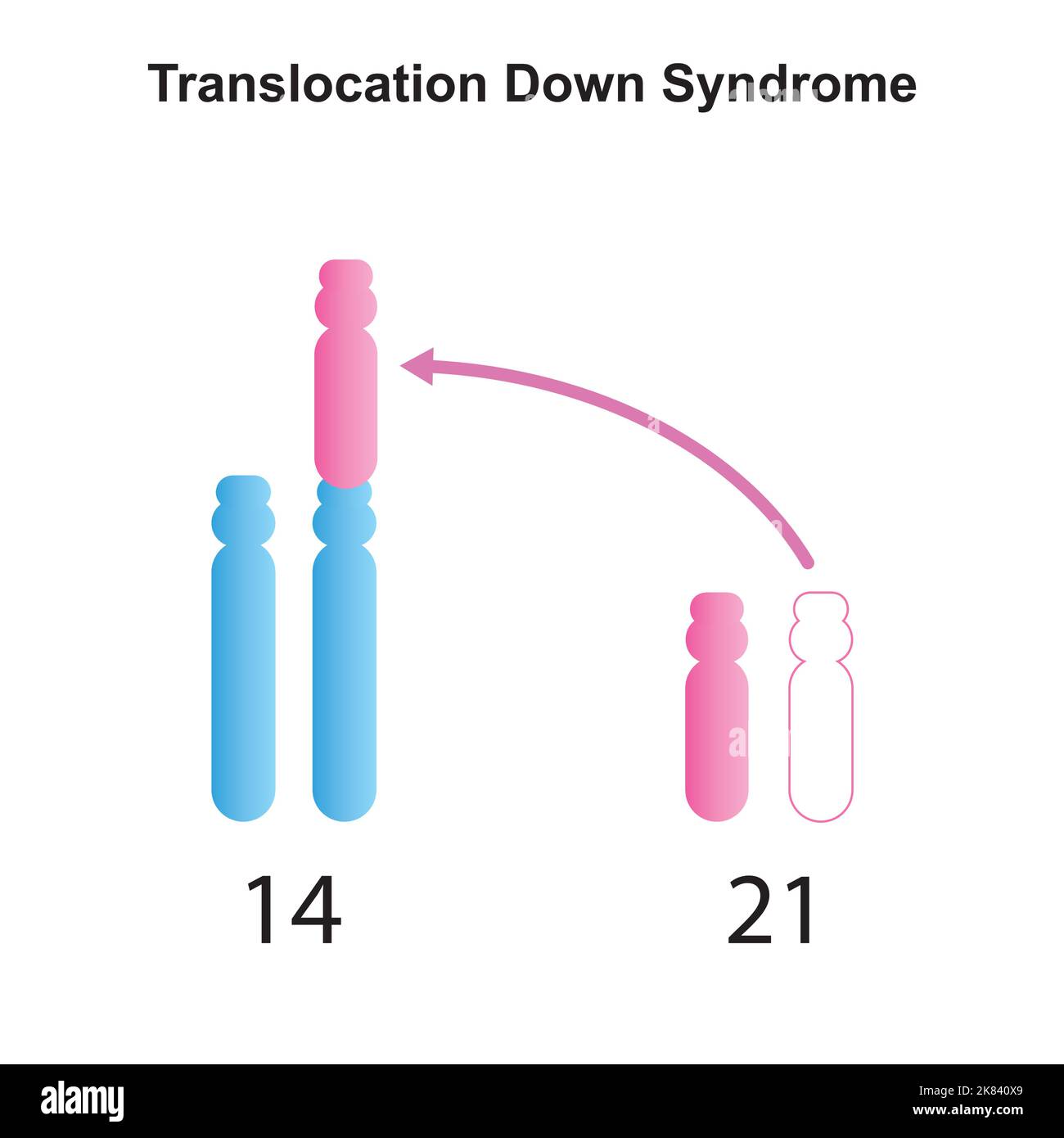 Progettazione scientifica della sindrome di traslocazione di Robertsonian giù. Simboli colorati. Illustrazione vettoriale. Illustrazione Vettoriale