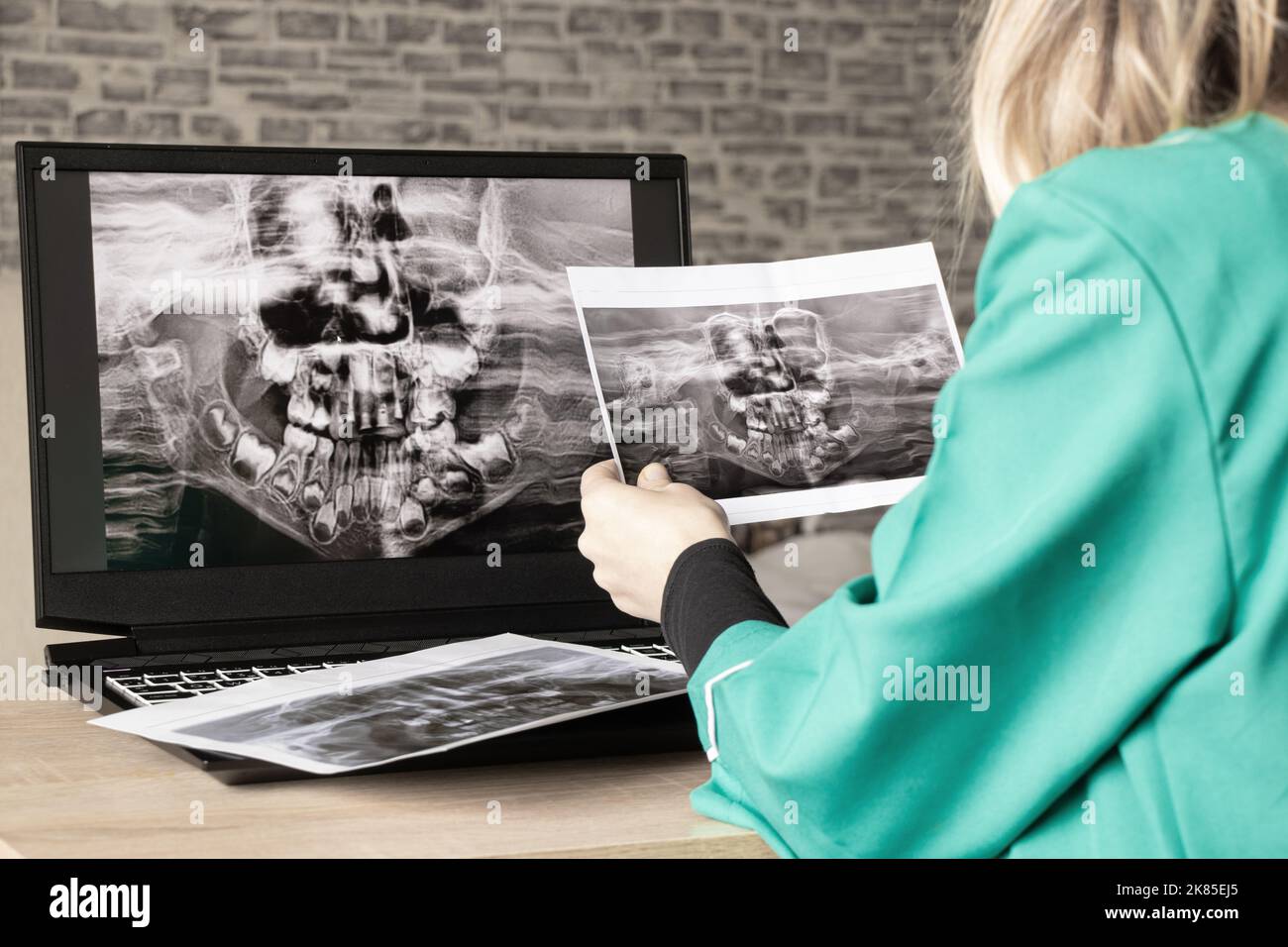 Radiografia panoramica dei denti dei bambini di due mascelle, ortopantomogramma dei denti dei bambini su schermi di computer portatile al tavolo del medico, diagnostica Foto Stock