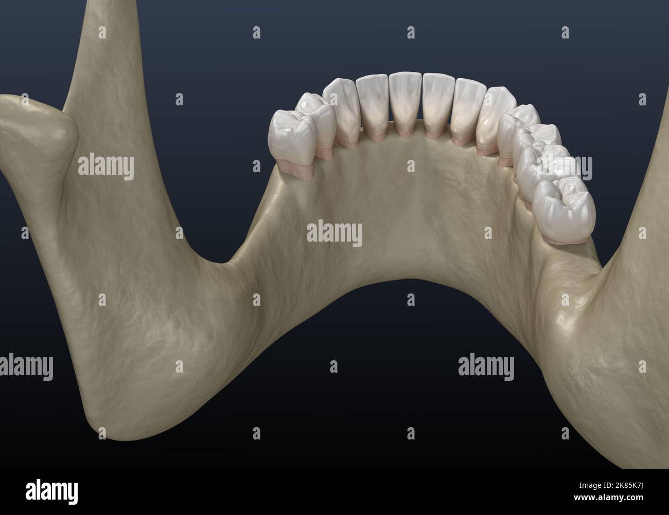 Ganascia mandibolare, recessione ossea dopo la perdita di denti molari. Illustrazione dentale 3D accurata dal punto di vista medico Foto Stock