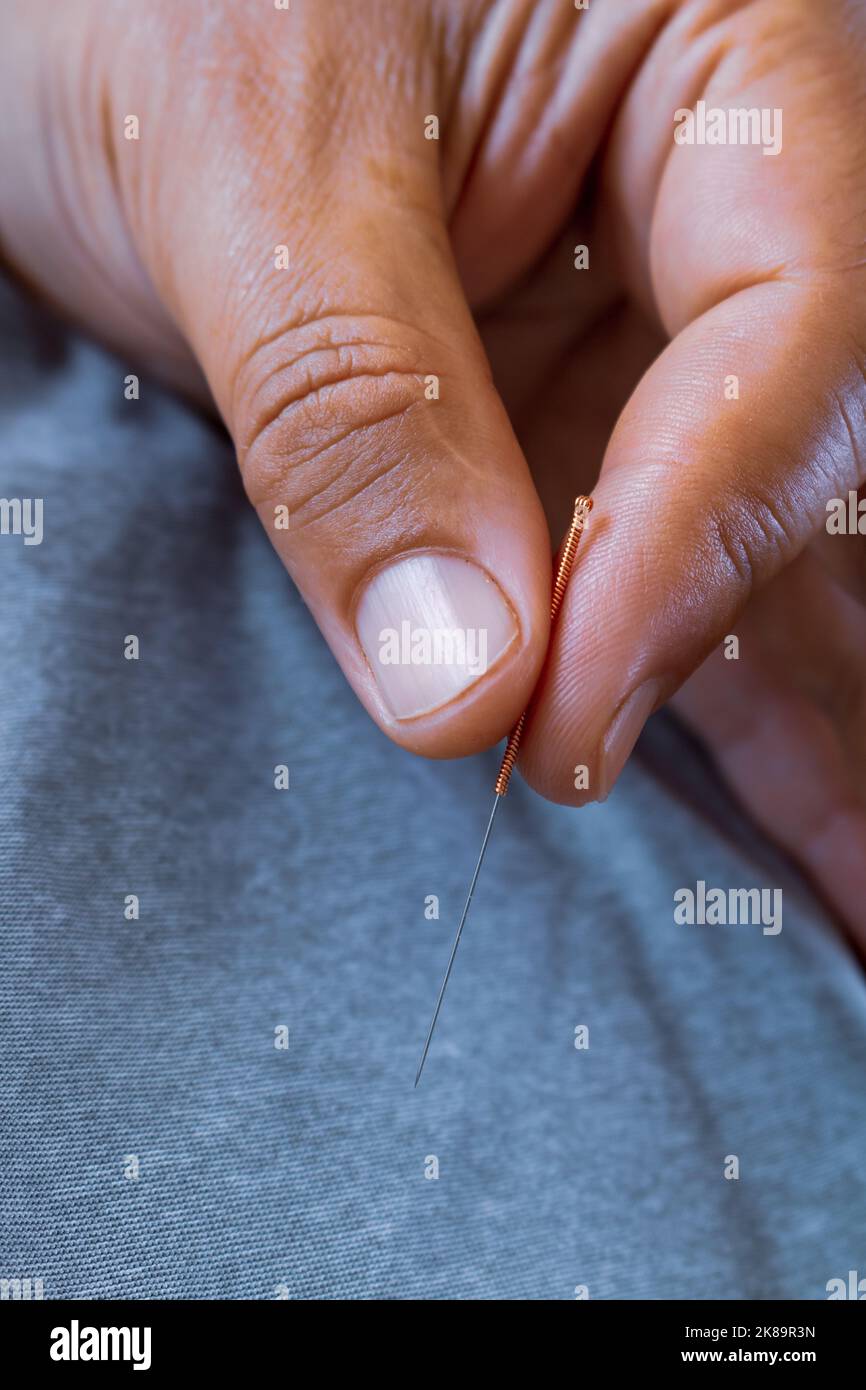 Medico acupuncturista tenendo tra le dita un ago di acciaio. Elemento metallico per il trattamento di medicina orientale. Foto Stock