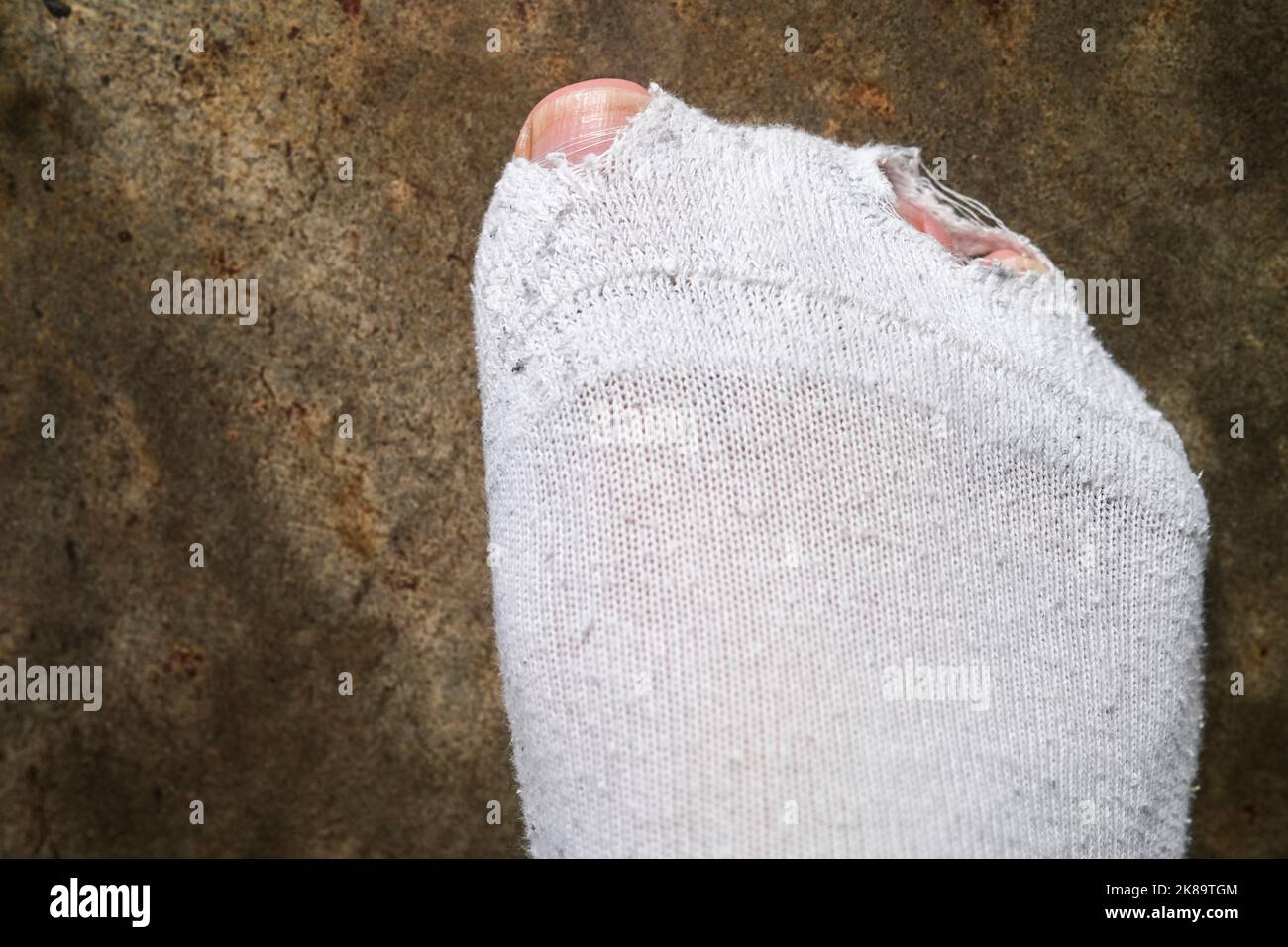 Le dita dell'uomo che attraversano i fori nei calzini bianchi, concetto di hardship Foto Stock