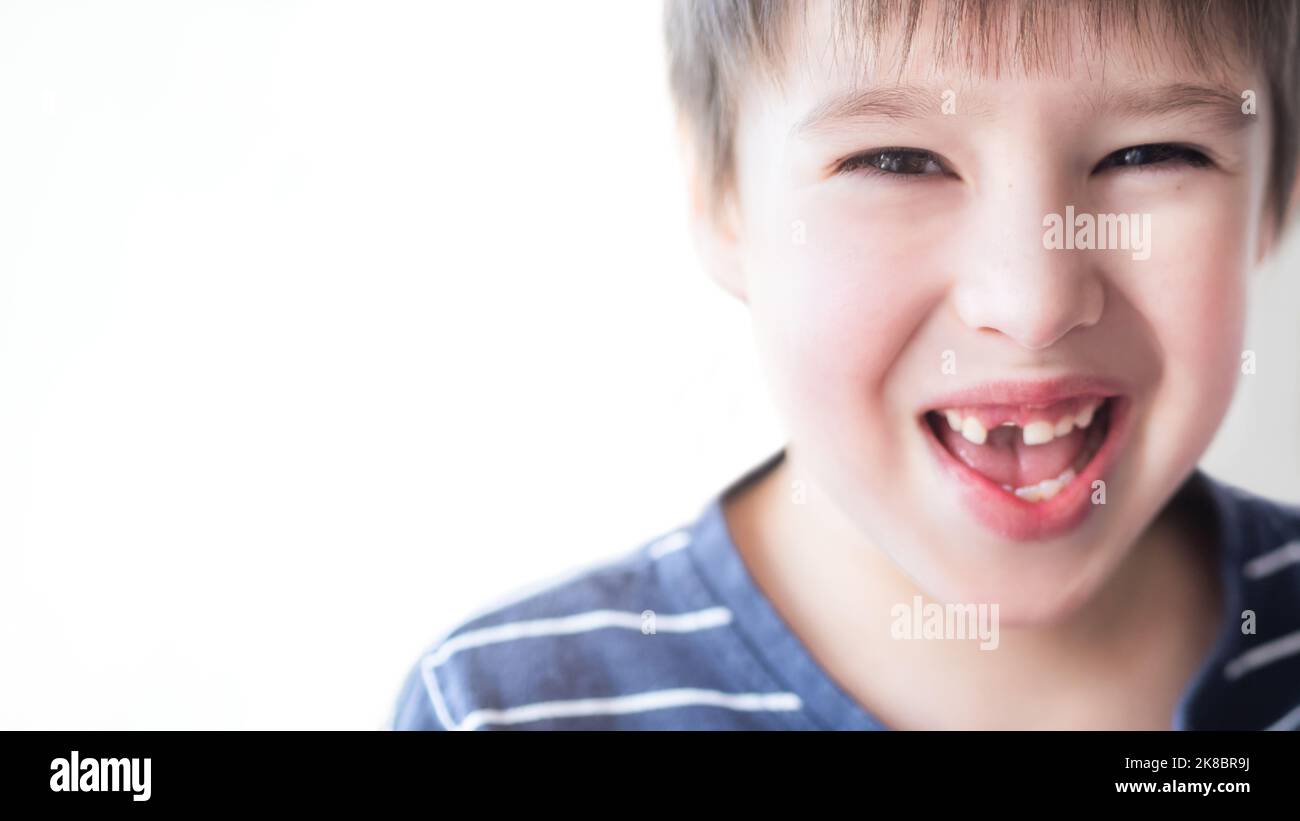 Il ragazzo sorridente mostra un buco in fila di denti in bocca. Un incisor è caduto fuori appena ora. Primo piano foto gengive per dentista. Spazio di copia. Foto Stock