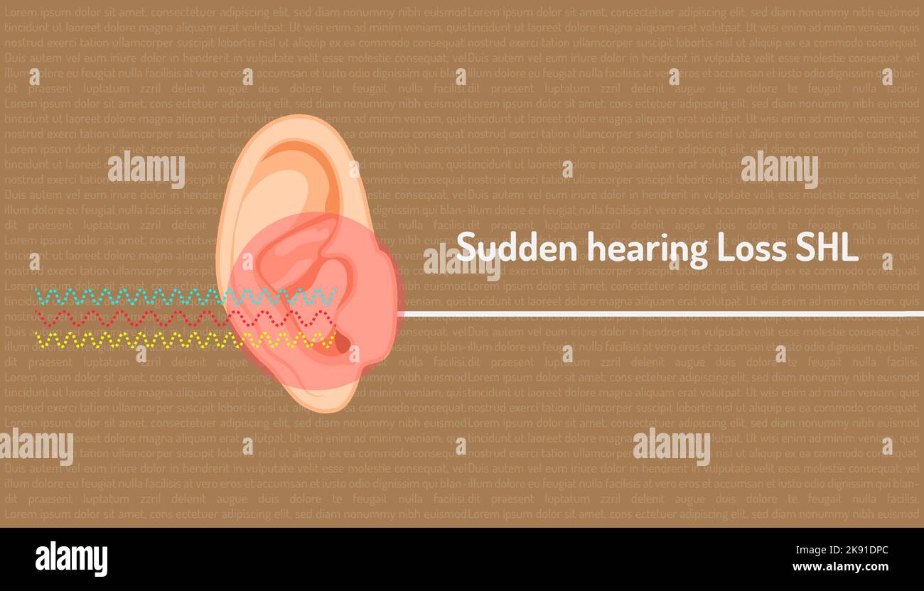 Un poster sulla SHL di perdita improvvisa dell'udito Illustrazione Vettoriale