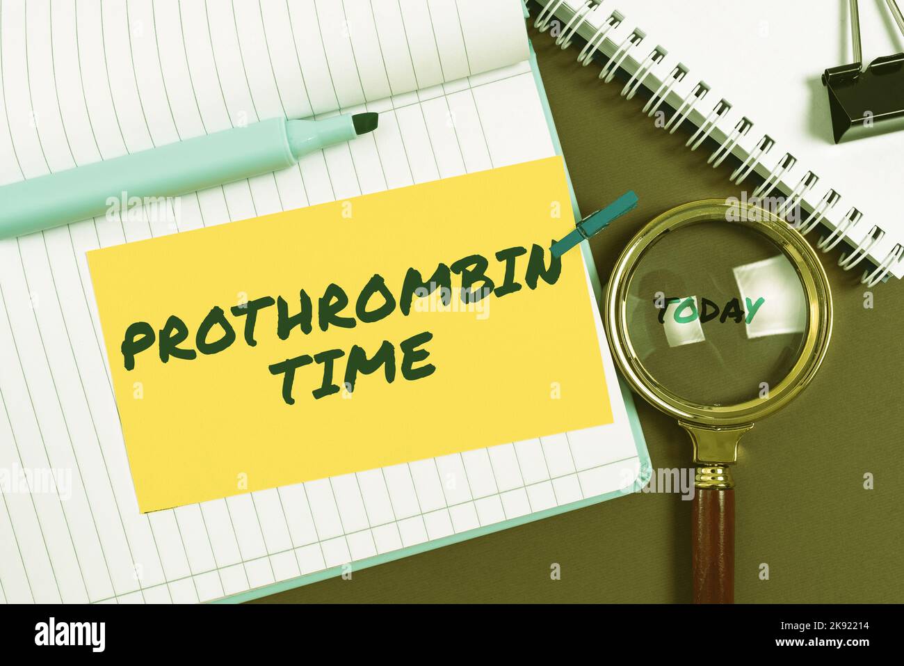 Didascalia concettuale tempo di protrombina. Stato concettuale della foto del rapporto tra il pubblico e un'azienda Foto Stock
