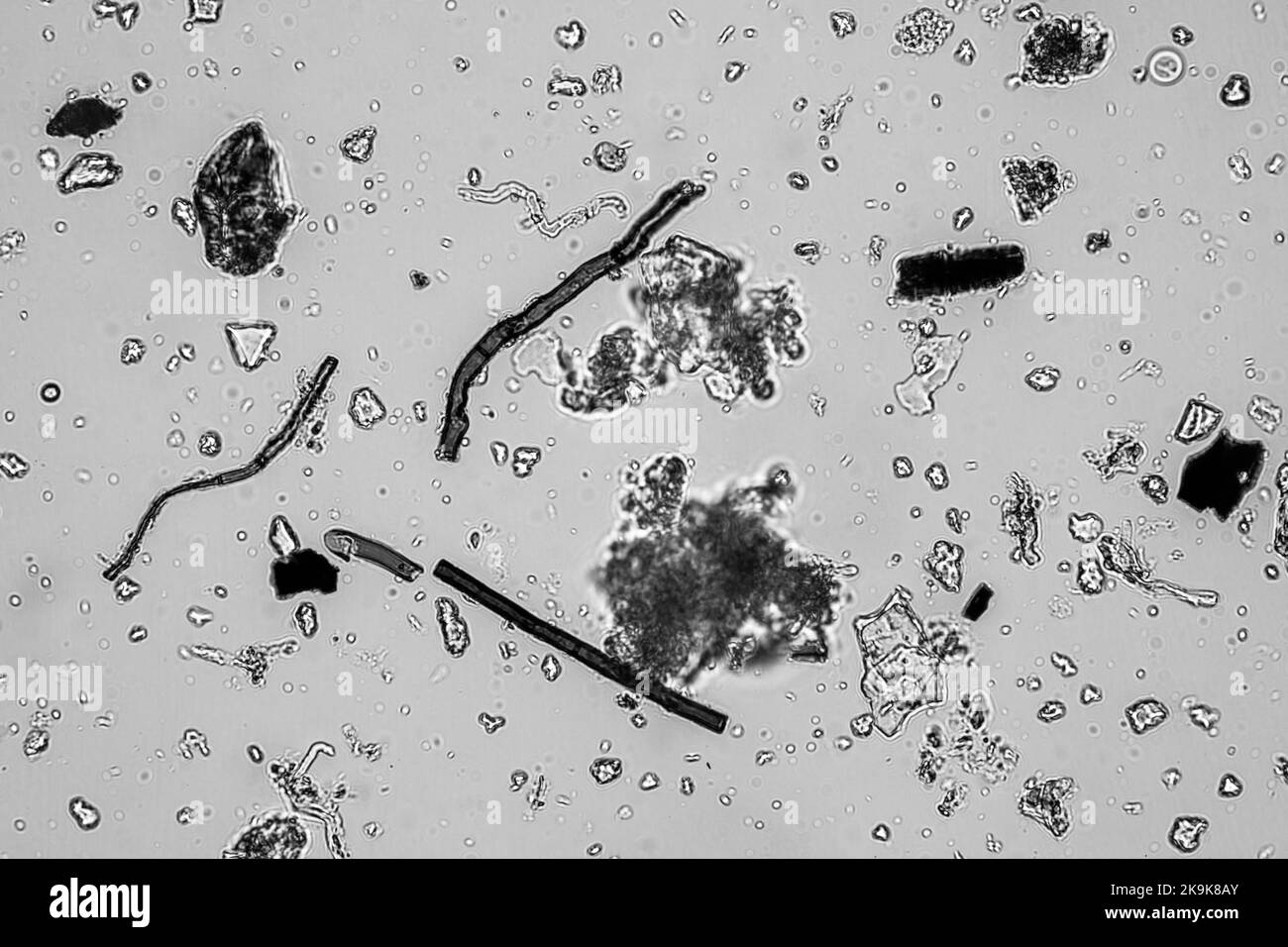 Funghi e funghi iphae al microscopio nel suolo e compost, in una biologia del suolo e test di microrganismi in Australia in primavera Foto Stock
