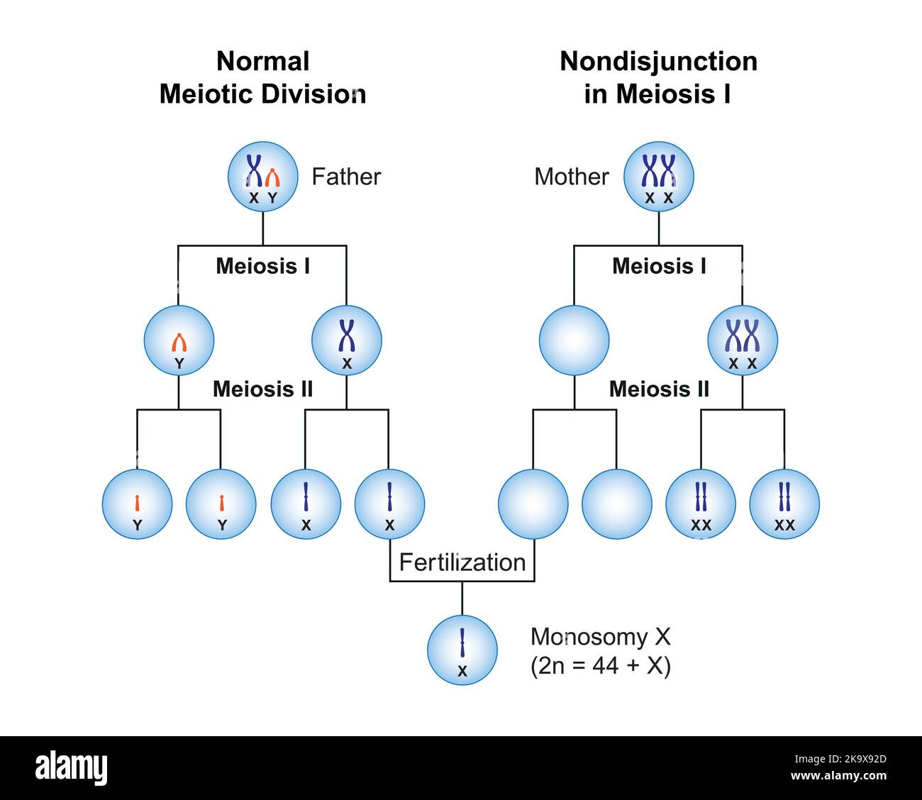 Progettazione scientifica della non-giunzione nella monosomia X (sindrome di Turner) . Simboli colorati. Illustrazione vettoriale. Illustrazione Vettoriale