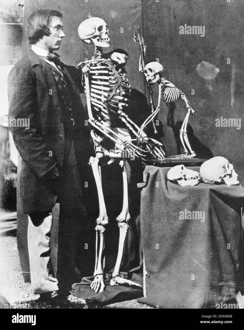 Charles Lutwidge Dodgson ('Lewis Carroll') Fotografia di Reginald Souhey con scheletri di umani e scimmie - 1857 Foto Stock