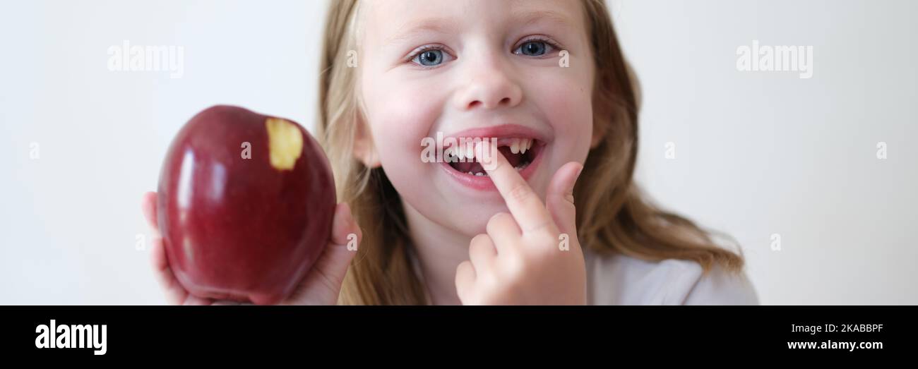 Sorridente ragazza senza dente sta tenendo la mela Foto Stock