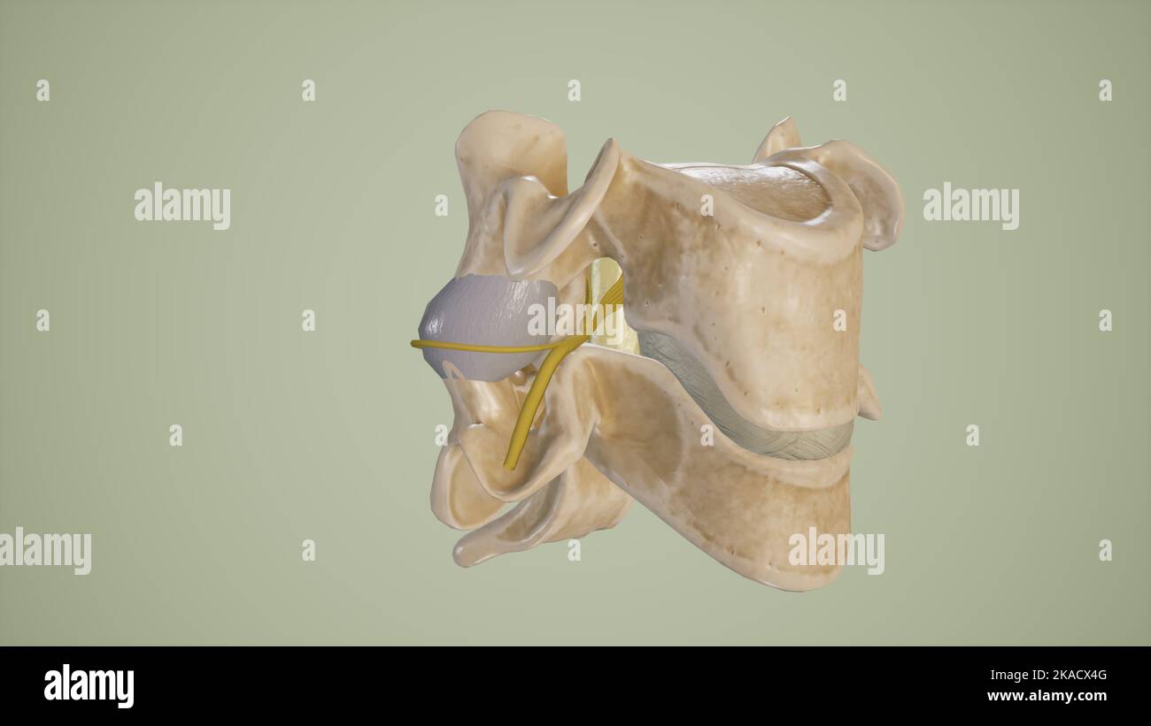 Illustrazione medica della foramina intervertebrale con nervi spinali emergenti Foto Stock