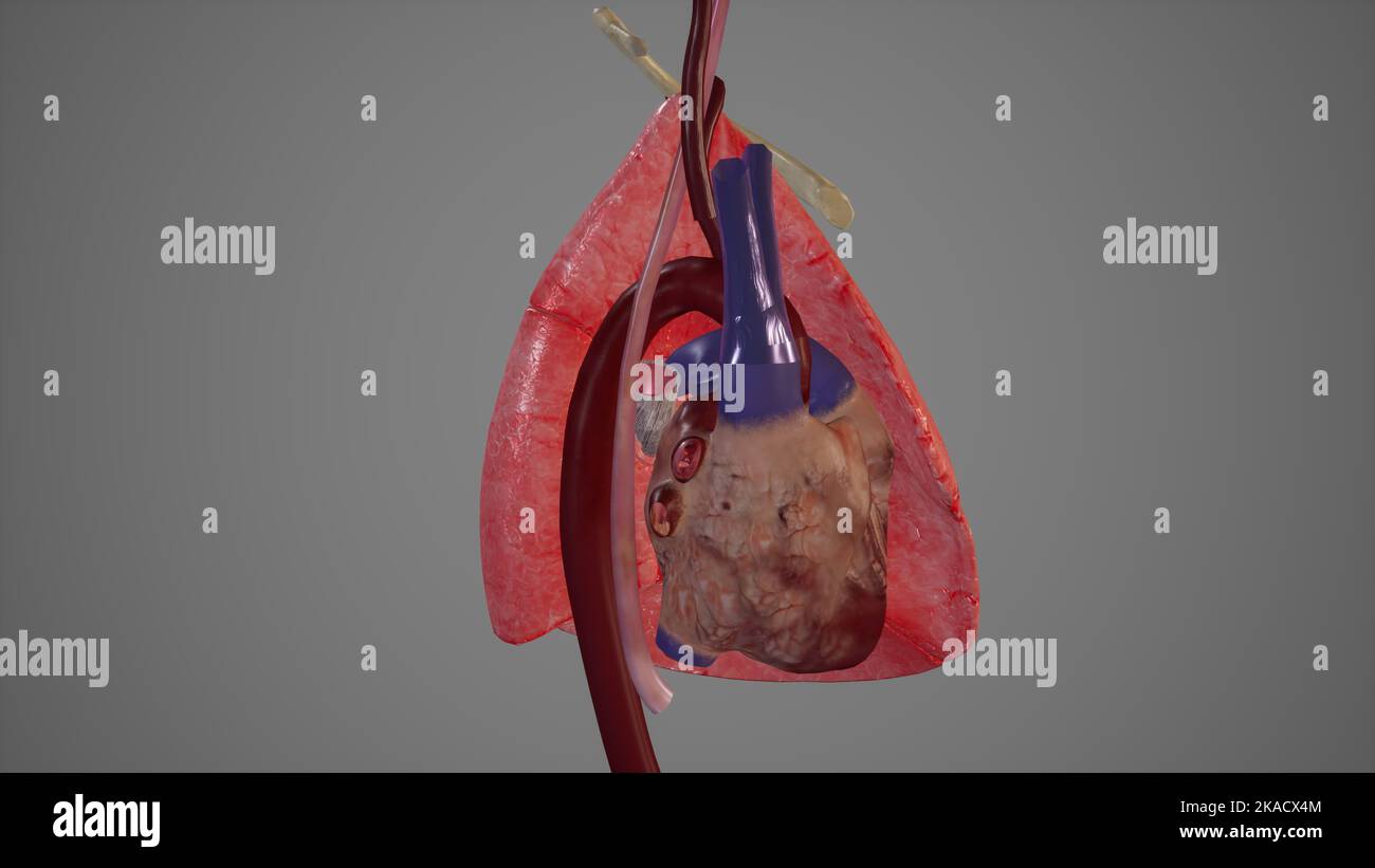 Vista mediale del polmone sinistro che mostra le strutture principali ad esso correlate Foto Stock