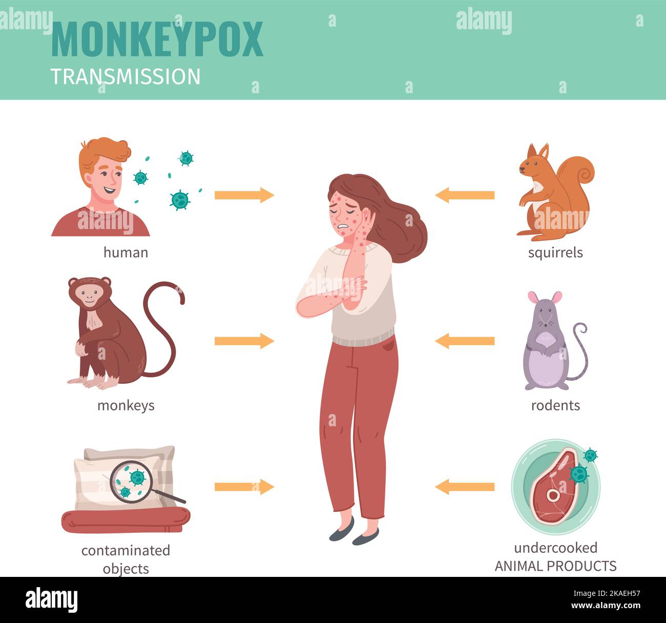 Infografica del virus della vaiolo delle scimmie con modalità di trasmissione da illustrazione vettoriale umana e animale Illustrazione Vettoriale