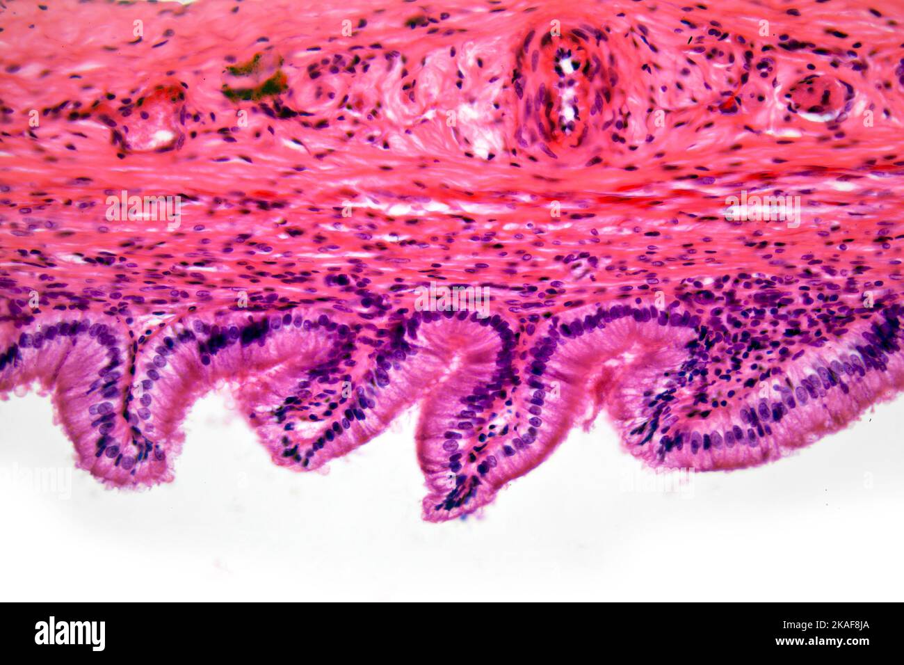 Human cistifellea sezione fotomicrografia in campo chiaro Foto Stock