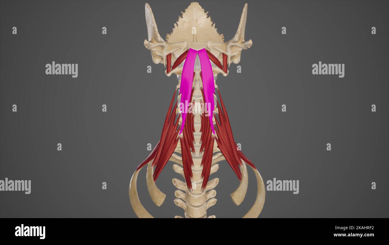 Medical accurata illustrazione del longus capitis Foto Stock