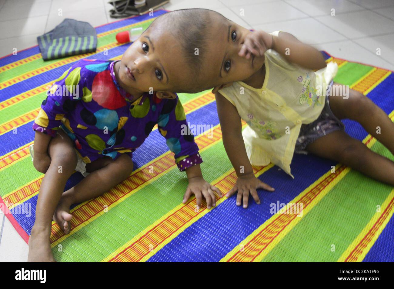 Le ragazze gemelle riunite Rabeya Islam e Rokeya Islam suonano presso un Dacca Medical Collage Hospital a Dhaka, Bangladesh il 21 novembre 2017. Taslima Khatun, insegnante di scuola, ha dato alla luce i gemelli a testa riunita il 16 luglio 2016 dopo un cesareo. I gemelli sono stati ammessi in un ospedale di Dacca Medical Collage per l'esame prima di un intervento chirurgico potenziale per separare le loro teste. (Foto di Mamunur Rashid/NurPhoto) Foto Stock