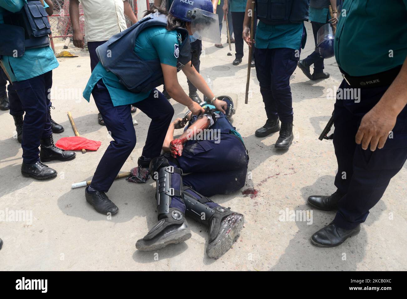 Un poliziotto ferito durante gli scontri tra operai e polizia a Dhaka, Bangladesh, il 16 marzo 2021. Indumenti lavoratori di Stitch Well Design Limited e Apparel Stitch Limited fase una dimostrazione di blocco stradale che richiede i loro salari dovuti a Dhaka. (Foto di Mamunur Rashid/NurPhoto) Foto Stock