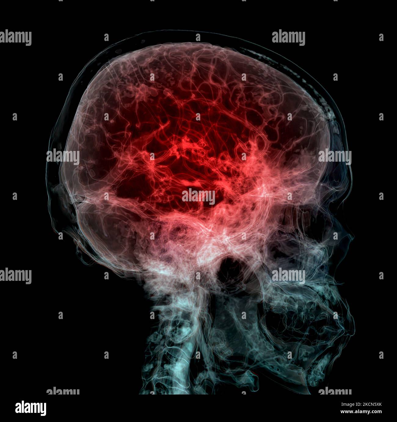 3D ha reso clinicamente accurata l'illustrazione dell'arteria cerebrale della testa Foto Stock
