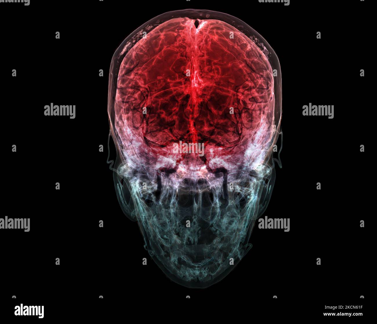 3D ha reso clinicamente accurata l'illustrazione dell'arteria cerebrale della testa Foto Stock