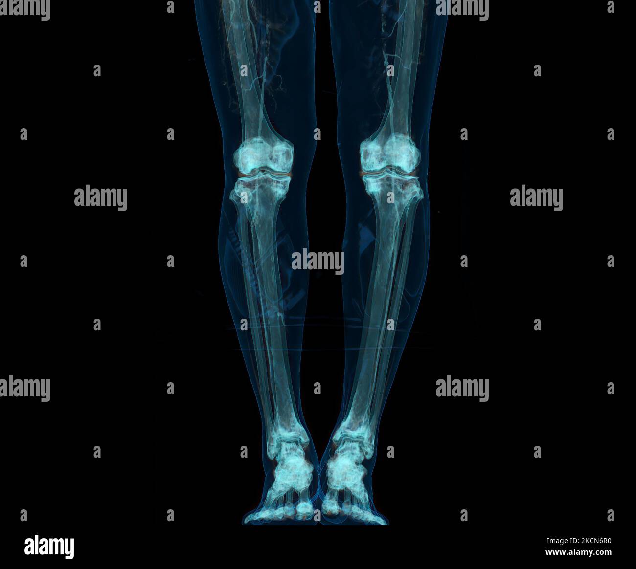 3D rappresentazione dell'estremità inferiore o delle gambe isolate su sfondo nero. Foto Stock