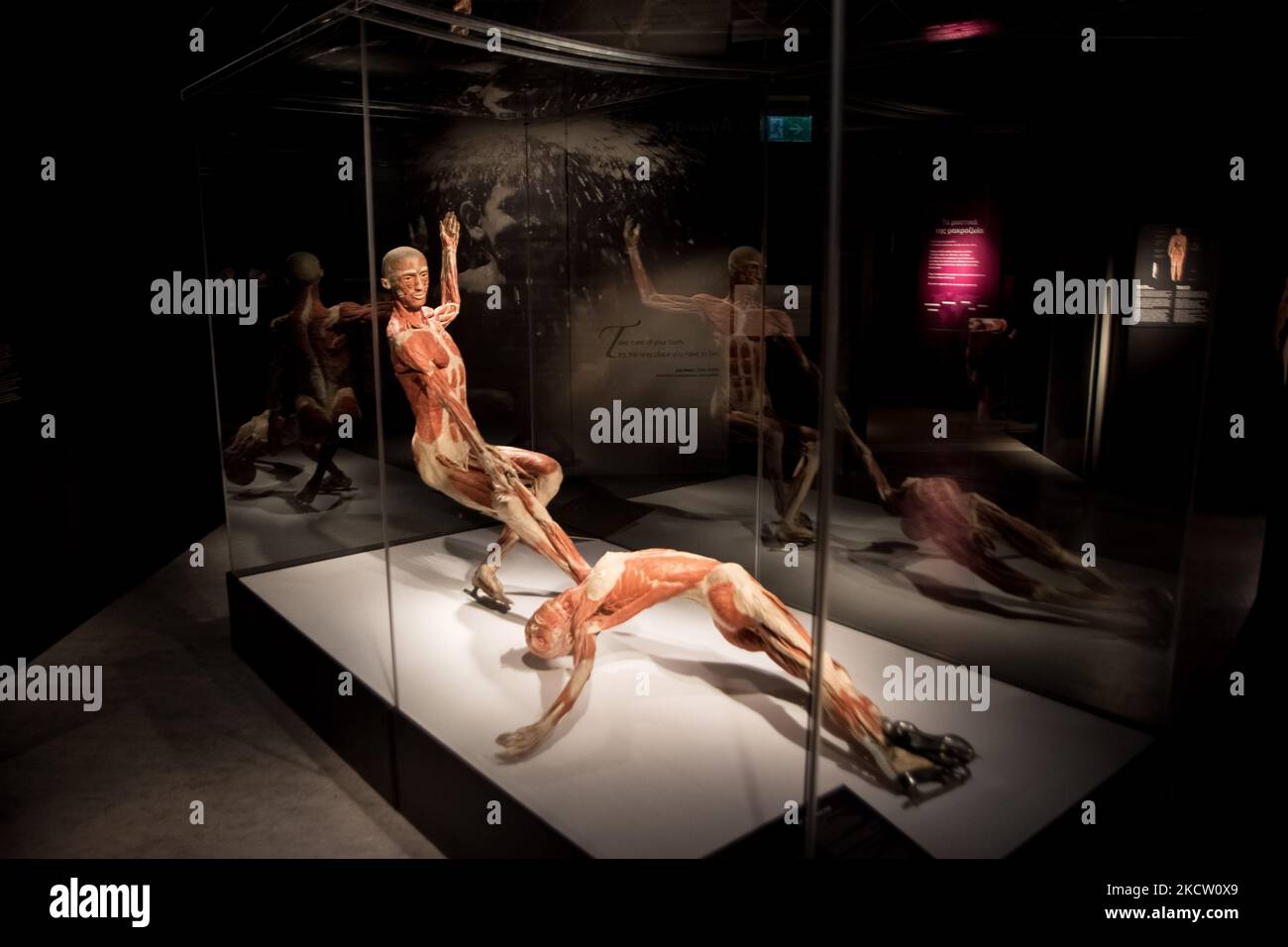 Body Worlds è una mostra di veri corpi umani e contiene veri esemplari umani ad Atene, in Grecia, il 15 novembre 2021. (Foto di Nikolas Kokovlis/NurPhoto) Foto Stock
