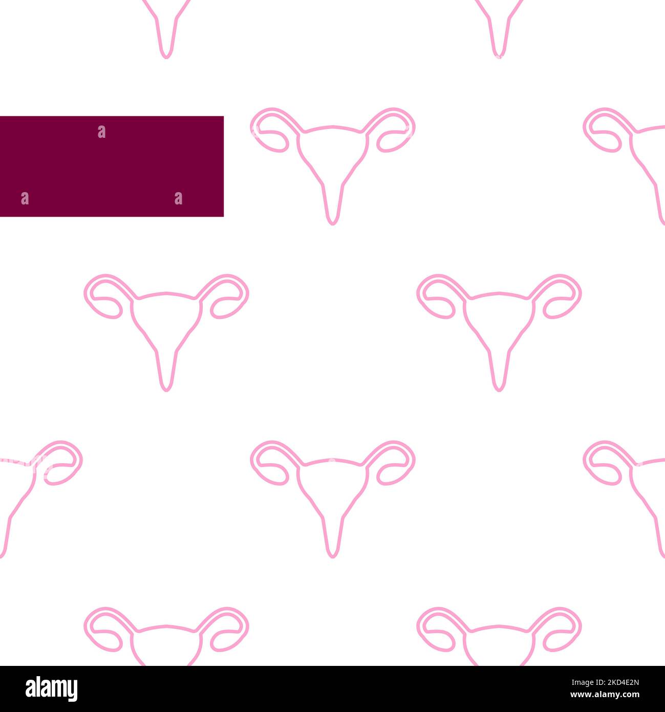 Endometriosi, illustrazione concettuale Foto Stock