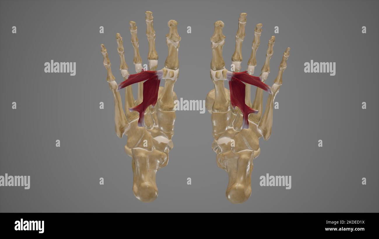 Solipedi Aponeurosi plantare immagini e fotografie stock ad alta risoluzione - Alamy