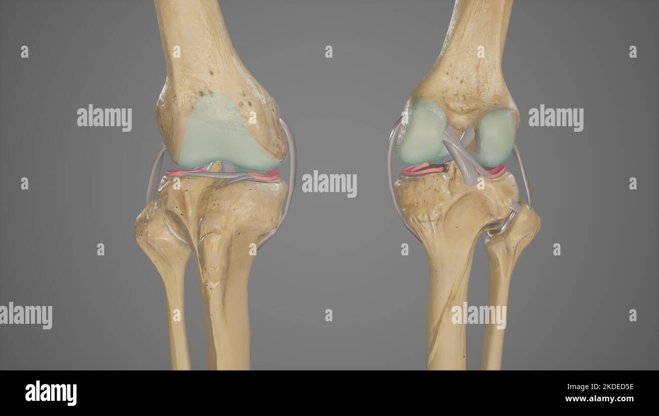 Vista anteriore e posteriore dell'articolazione del ginocchio con rotula rimossa Foto Stock