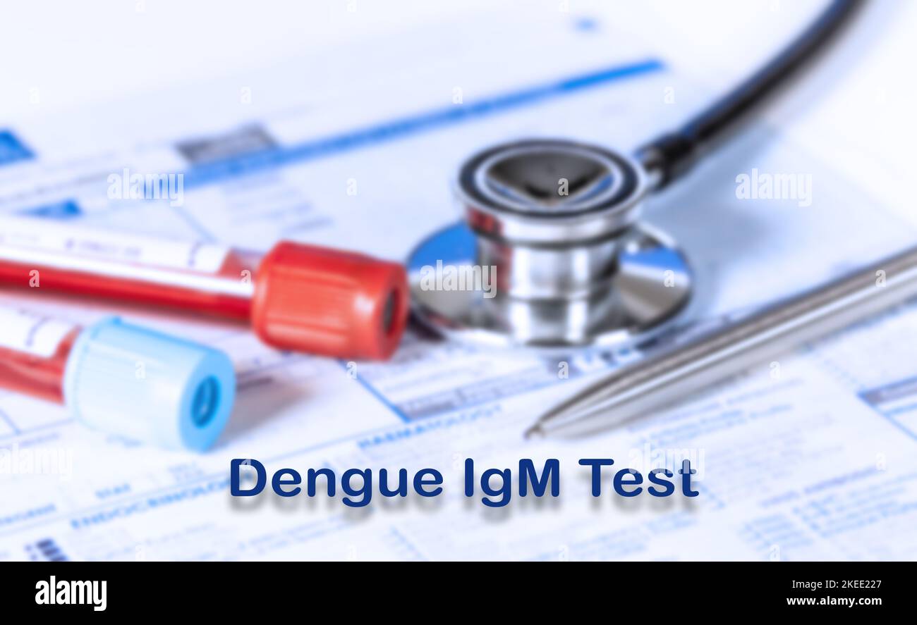 Test IgM dengue, immagine concettuale Foto Stock