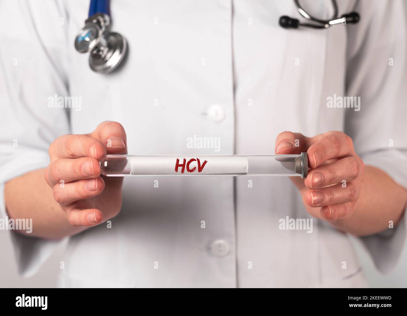 HCV acronimo di Medical test. Provetta Word. Foto Stock