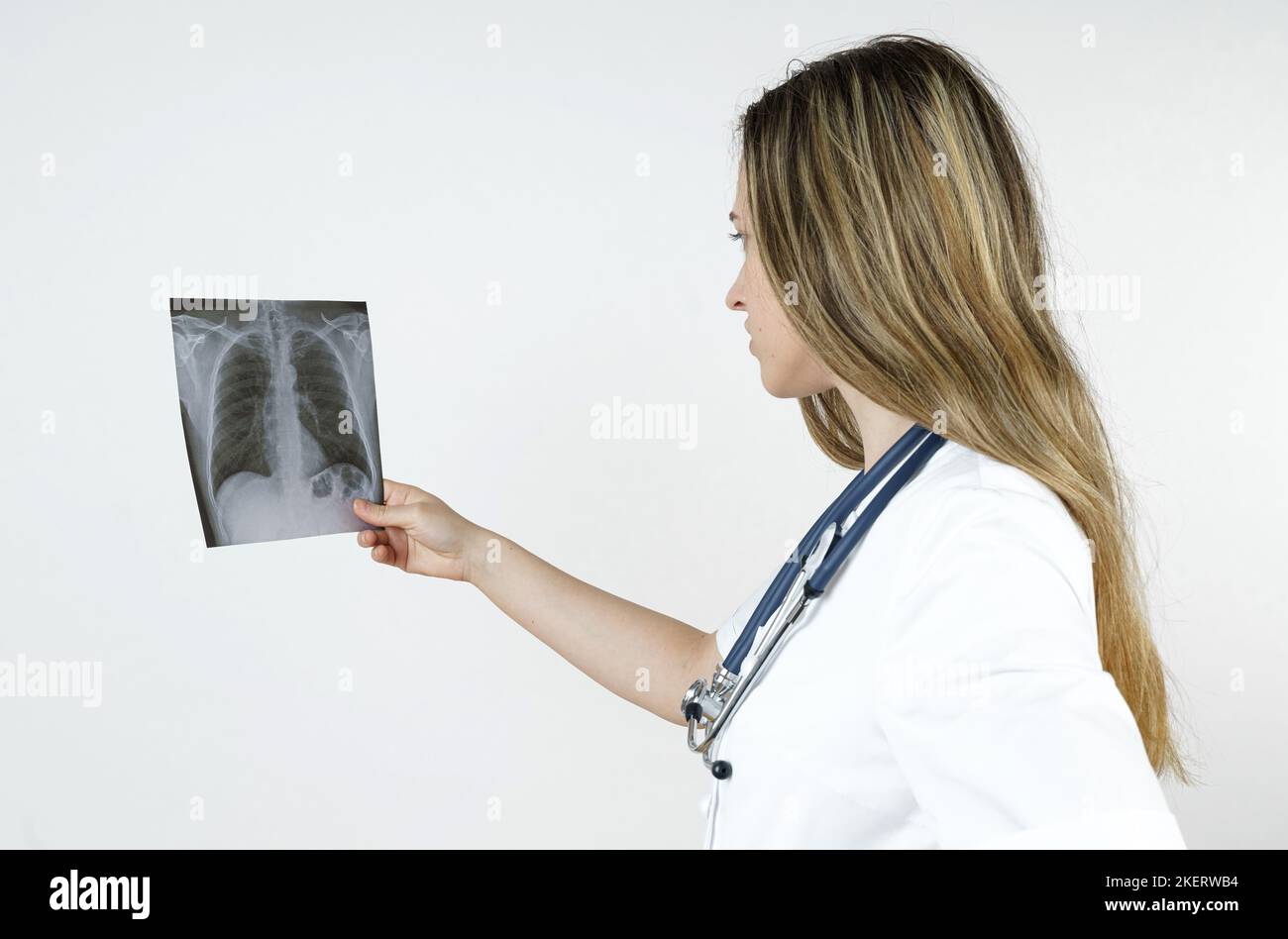 Medicina e concetto di salute. Una giovane donna medico esamina un'immagine radiografica del torace umano. Isolato su sfondo bianco. Foto Stock