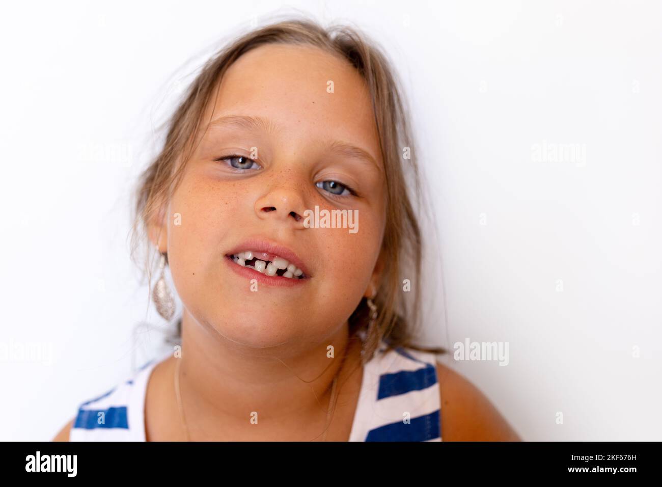 Spensierata, calma, sicura bambina bionda mostrare i denti temporanei del latte del bambino. Bocca senza denti con denti storti cambiati Foto Stock