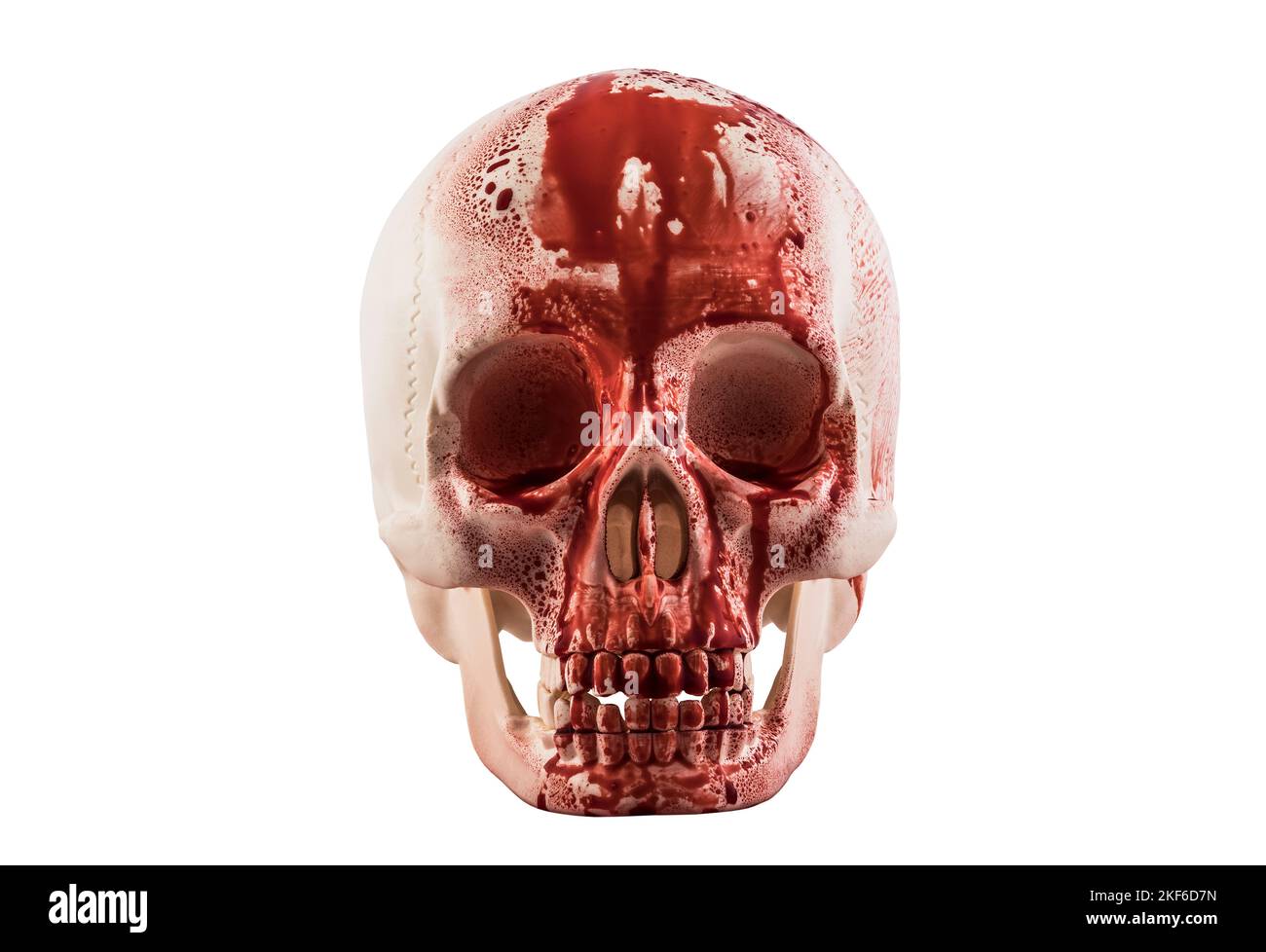 Cranio umano nel sangue isolato su sfondo bianco con tracciato di ritaglio Foto Stock