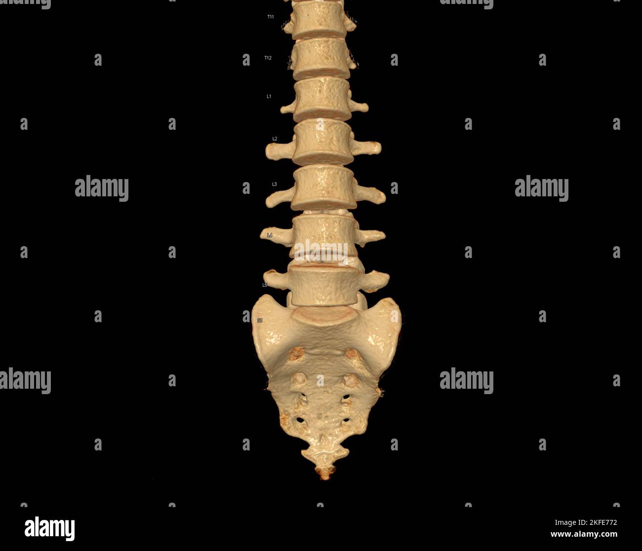 Scansione TC del rendering colonna lombare 3D che mostra il profilo colonna vertebrale umana. Sistema muscoloscheletrico corpo umano. Colonna vertebrale strutturale. Studiare la malattia di problema e tre Foto Stock