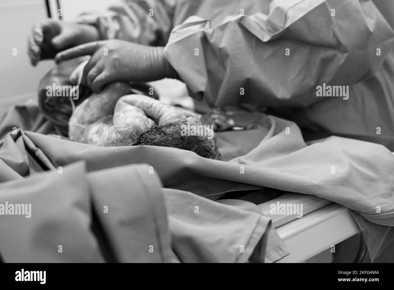 Un neonato che viene pulito da un pediatra immediatamente dopo la nascita Foto Stock
