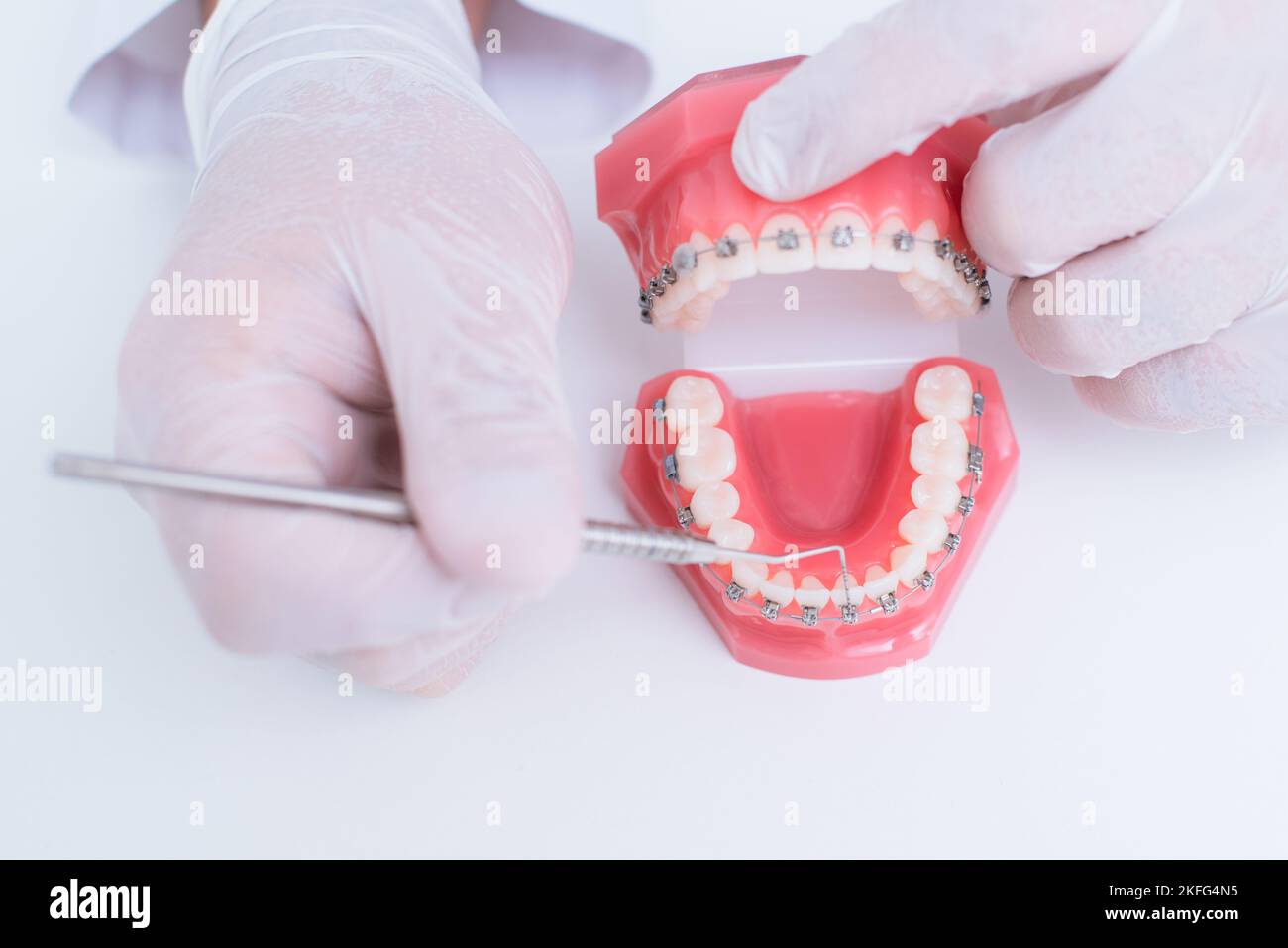 Il medico mostra come il sistema di bretelle sui denti è disposto Foto Stock