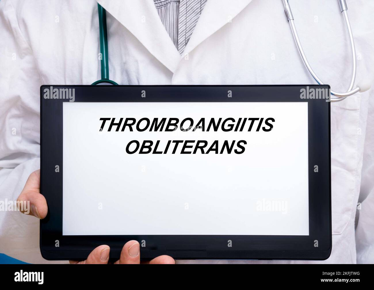 Thromboangitis obliterans, immagine concettuale Foto Stock