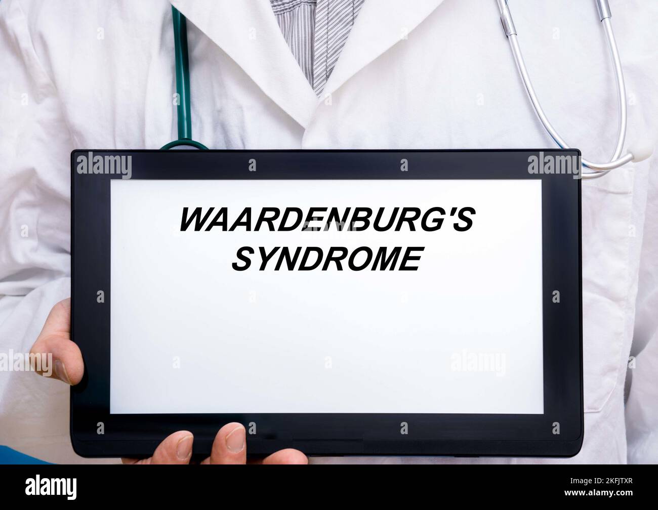 Sindrome di Waardenburg, immagine concettuale Foto Stock