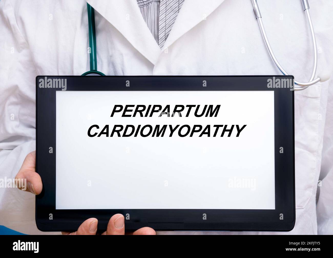 Cardiomiopatia peripartum, immagine concettuale Foto Stock