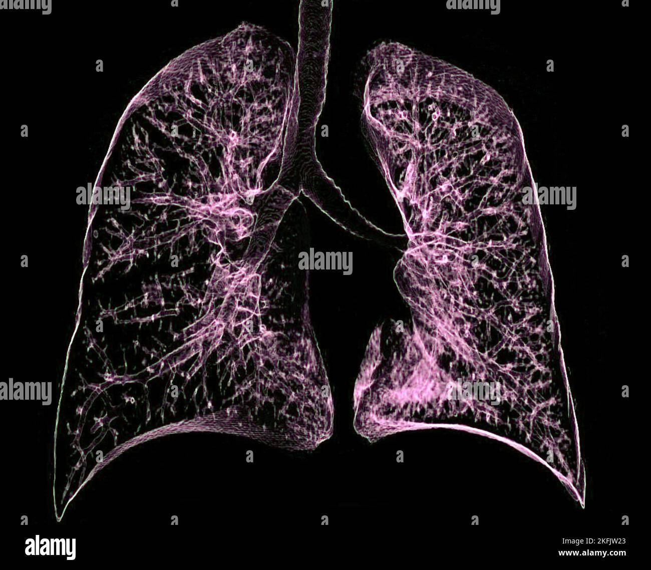 Polmoni sani, 3D CT scan Foto Stock