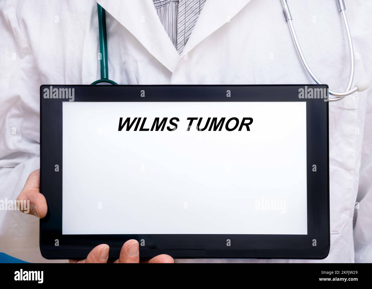 Wilms Tumor, immagine concettuale Foto Stock