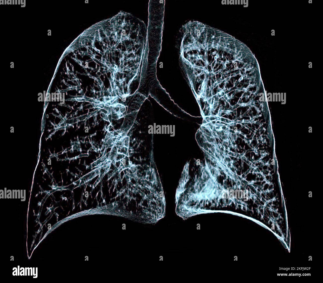 Polmoni sani, 3D CT scan Foto Stock