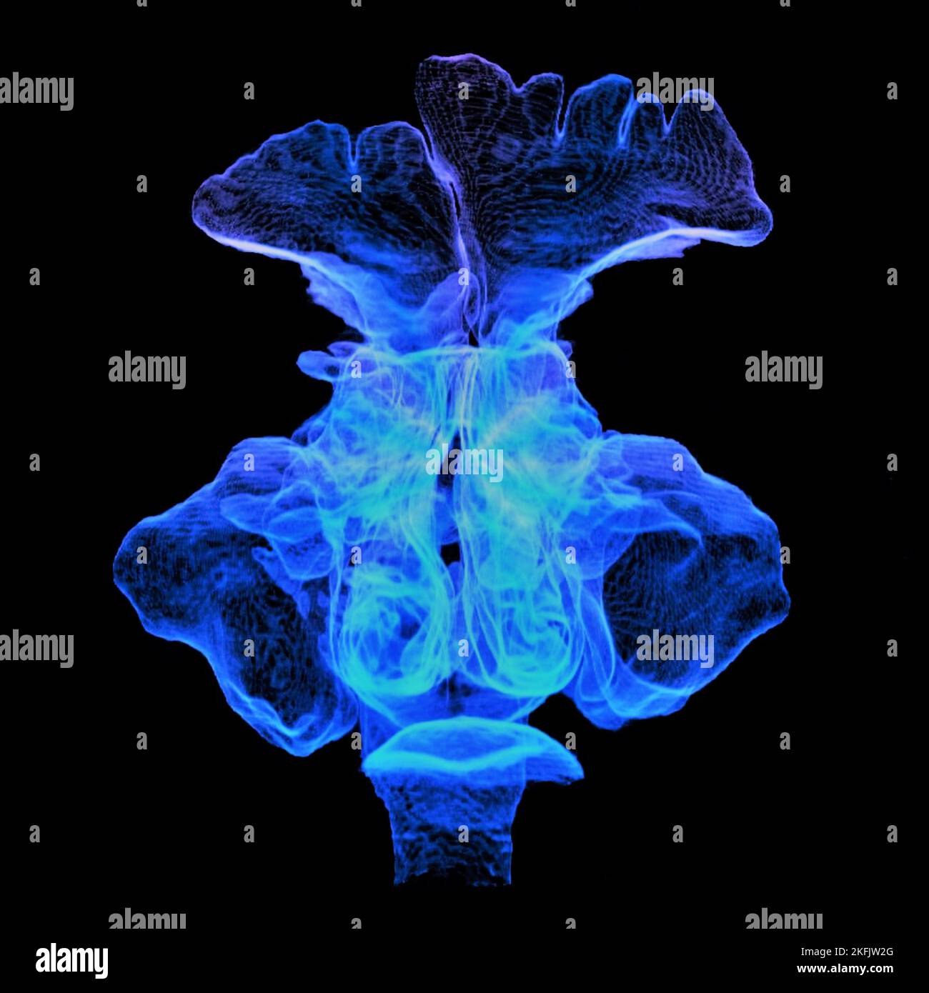 Sins paranasali, scansione 3D CT Foto Stock