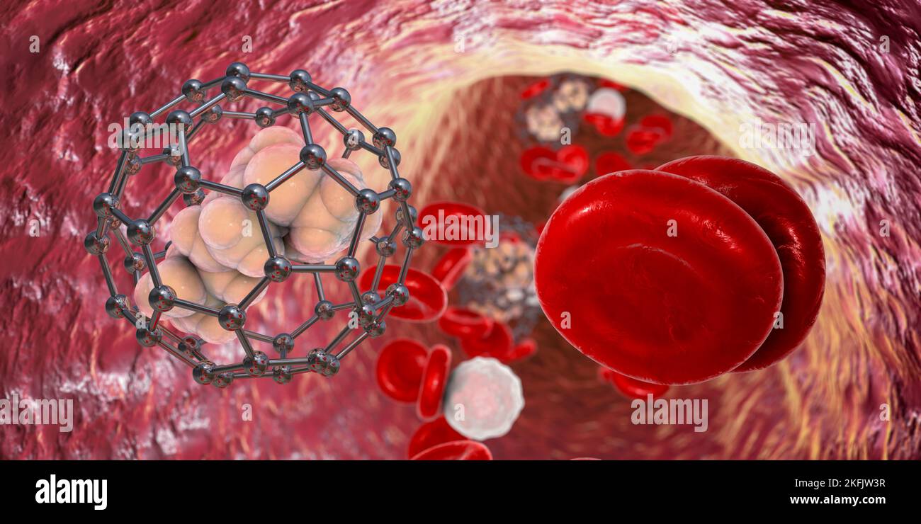 Nanoparticelle di fullerene nel sangue, illustrazione Foto Stock