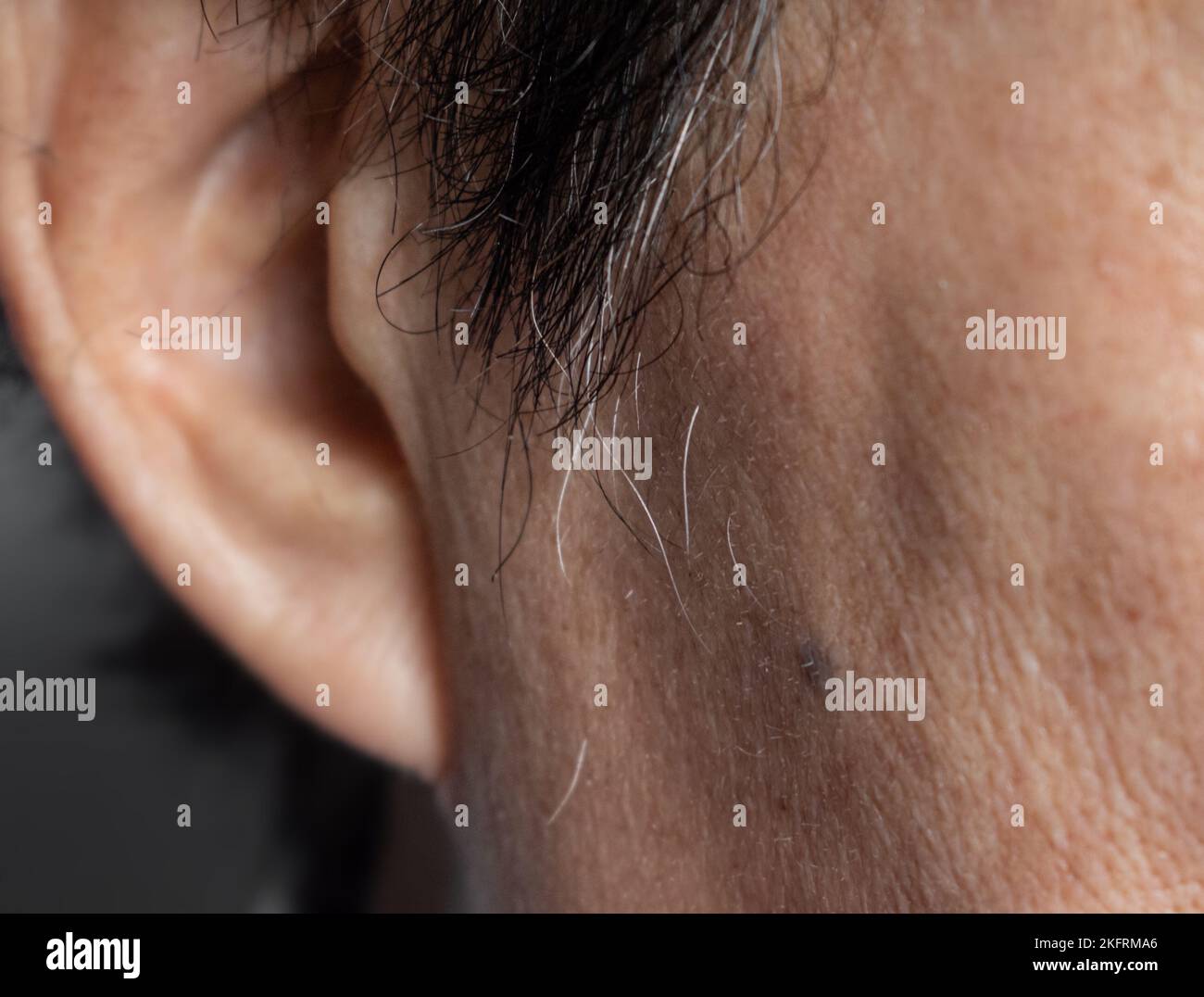 I cambiamenti di colore grigio dei capelli in vecchio asiatico. Concetto di invecchiamento. Foto Stock