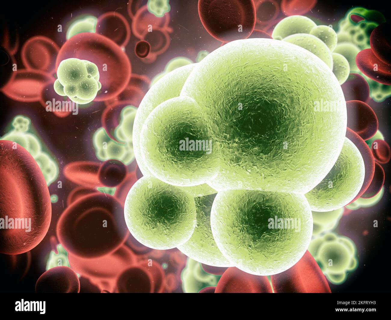 L'infezione si sta diffondendo. Vista microscopica dei batteri che attaccano le cellule sane nel corpo umano. Foto Stock