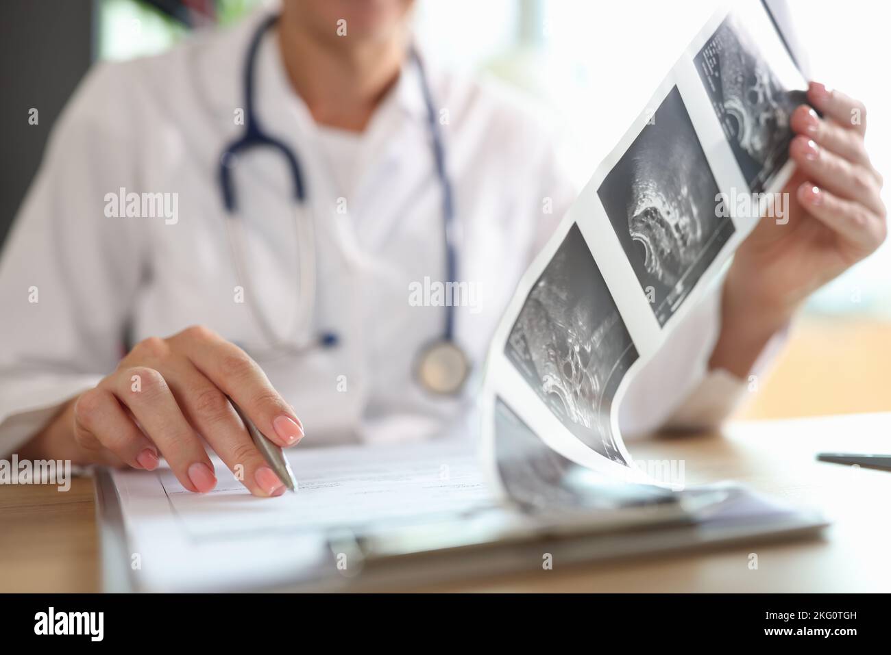 Medico di sesso femminile che guarda la descrizione degli shot ecografici del paziente Foto Stock