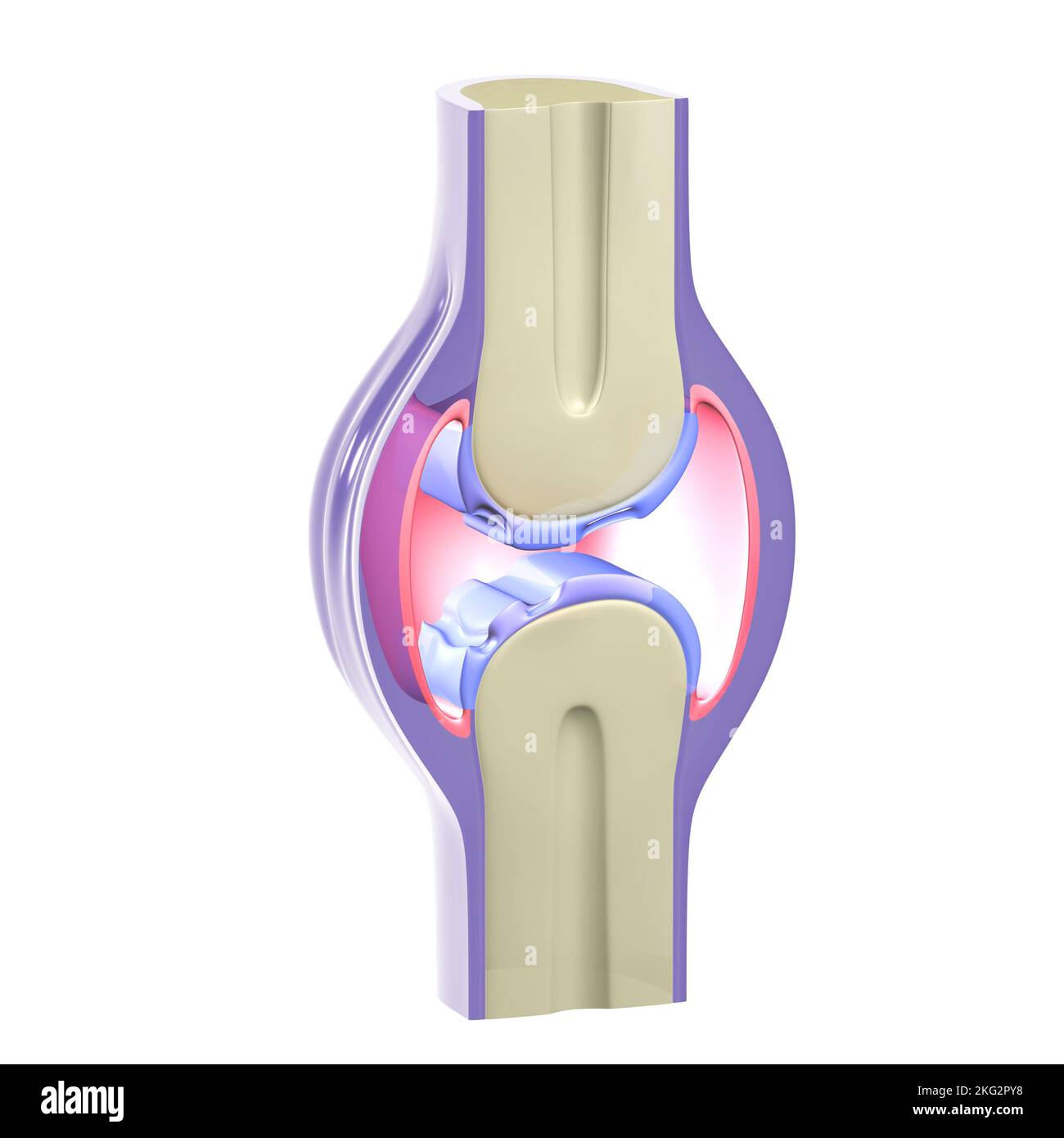 3D illustrazione di un'articolazione sinoviale con osteoartrite. Rappresentazione grafica di ossa, tendini e cartilagine su sfondo bianco. Foto Stock