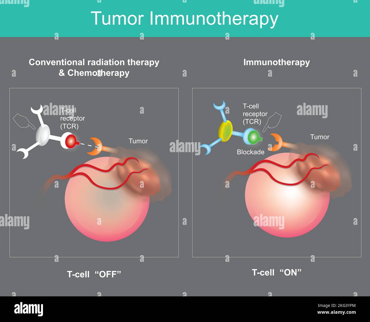 Immunoterapia tumorale. Trattamento del cancro che utilizza il proprio sistema immunitario per prevenire, controllare ed eliminare le cellule tumorali. Illustrazione Vettoriale